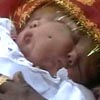 В Индии родилась двуликая четырехглазая девочка